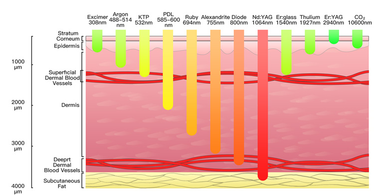 veterinary laser 1064nm
